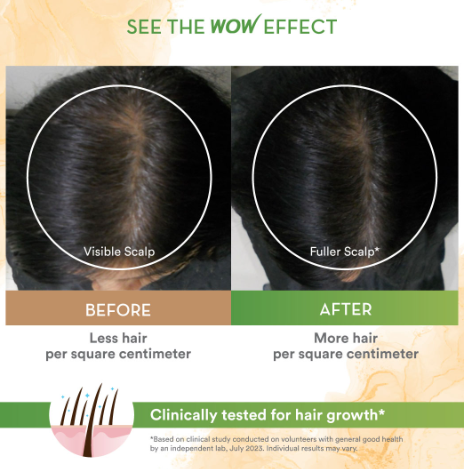WOW Skin Science Rosemary With Biotin Hair Oil 200 ml